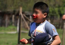 Aumentan lesiones oculares en niños por disparos de balines de plástico en la capital